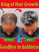 The most effective hair growth essential oil