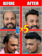 The most effective hair growth essential oil
