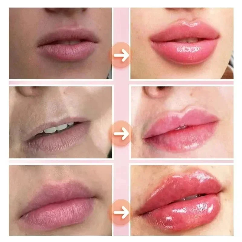 Instant Lip Plumping Essential Oil Nourishing Antiwrinkle Moisturising
