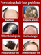 The most effective hair growth essential oil