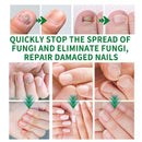 Jaysuing 7DAYS Ginger Anti Fungal Infection Foot Toe Nail with Fungus Treatments Oil Essence