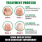 Jaysuing 7DAYS Ginger Anti Fungal Infection Foot Toe Nail with Fungus Treatments Oil Essence